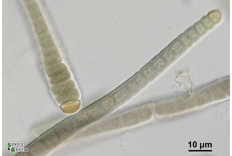 Microchaete