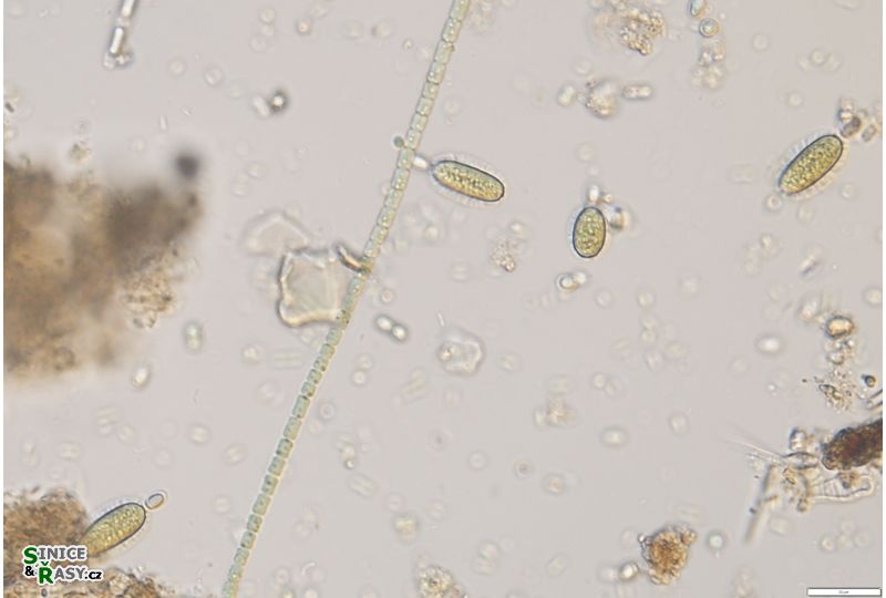 Cylindrospermum stagnale