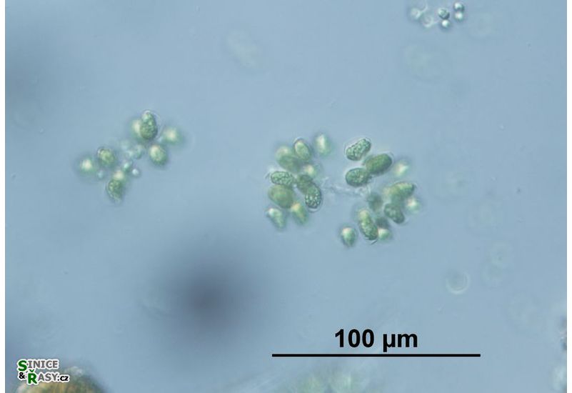 Dimorphococcus lunatus
