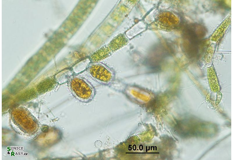 Bulbochaete sp.