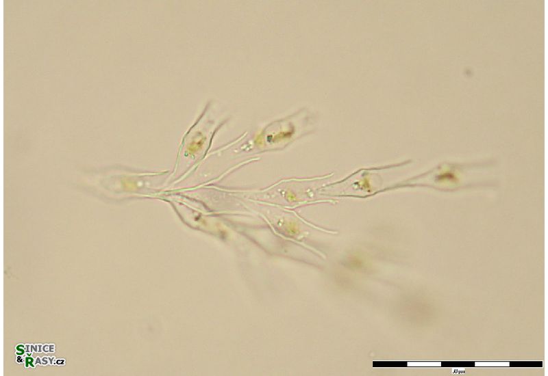 Dinobryon divergens