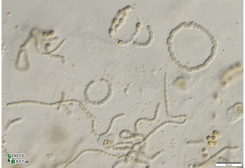 cf. Nostoc