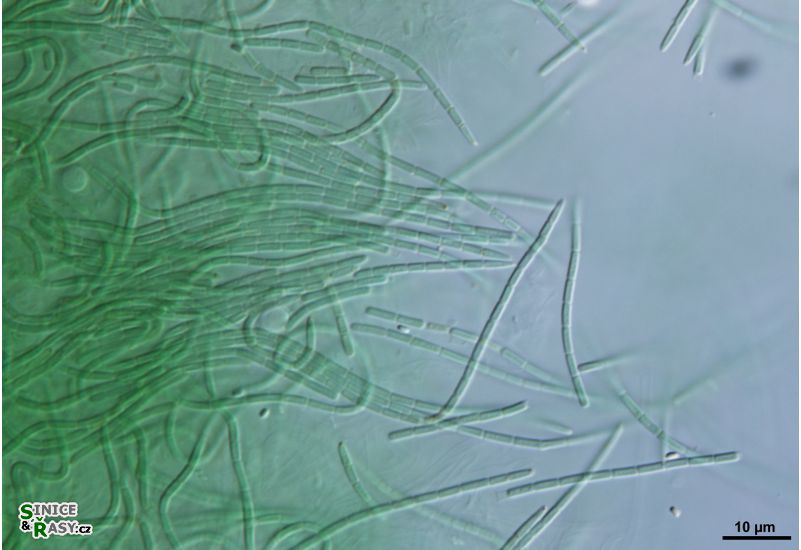 cf. Oculatella