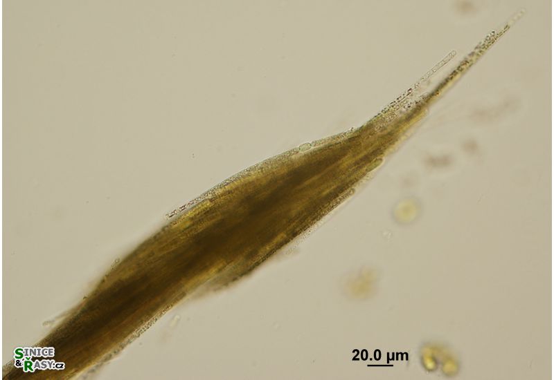 Aphanizomenon flos-aquae