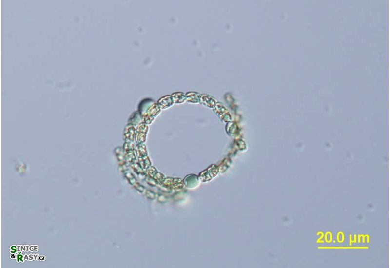 Dolichospermum sigmoideum
