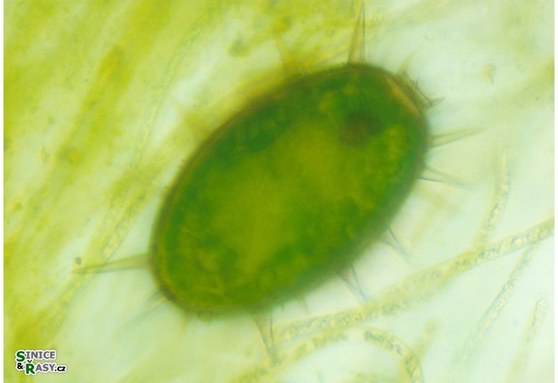 Trachelomonas