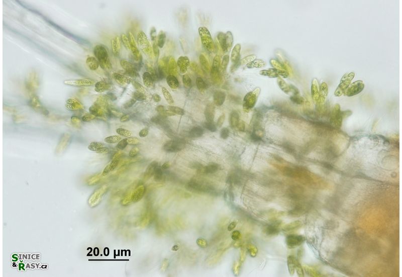 Colacium vesiculosum