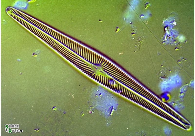 Navicula radiosa