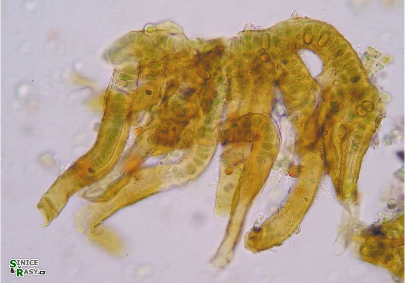 Stigonema