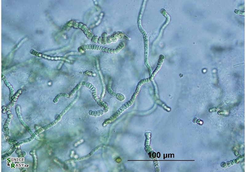Westiellopsis prolifica