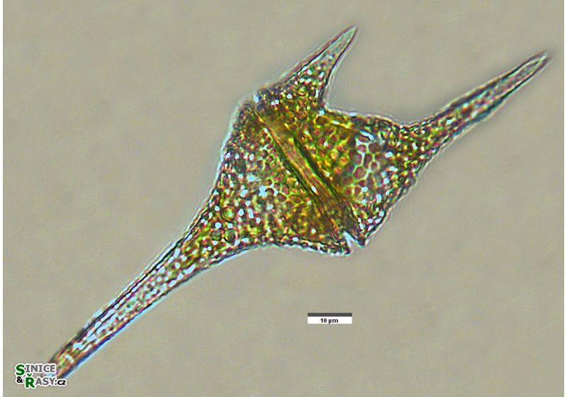 Ceratium hirundinella