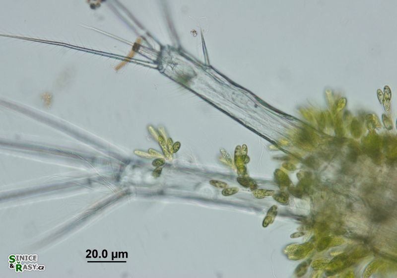 Colacium vesiculosum