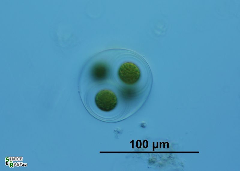 Asterococcus superbus