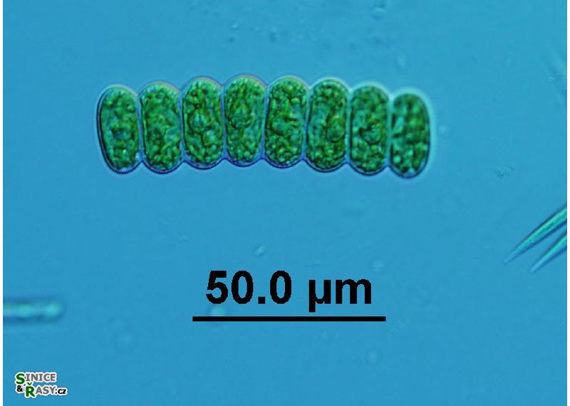 Scenedesmus ellipticus