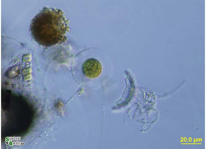 Planktosphaeria gelatinosa