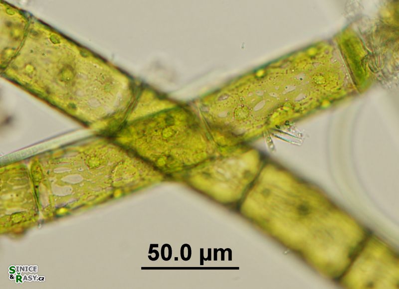 Oedogonium