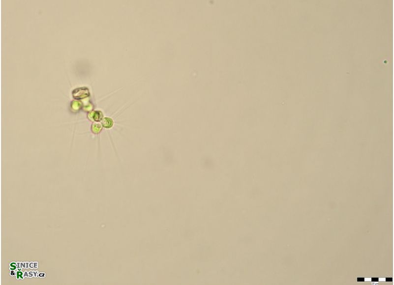 Micractinium pusillum