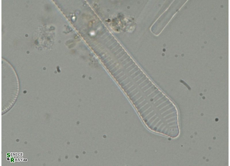 Fragilaria dilatata