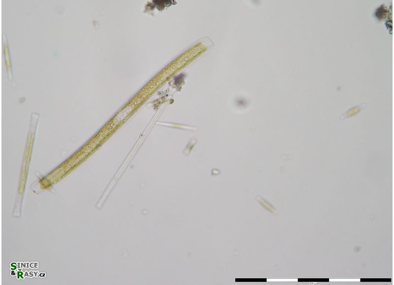 Nitzschia sigmoidea