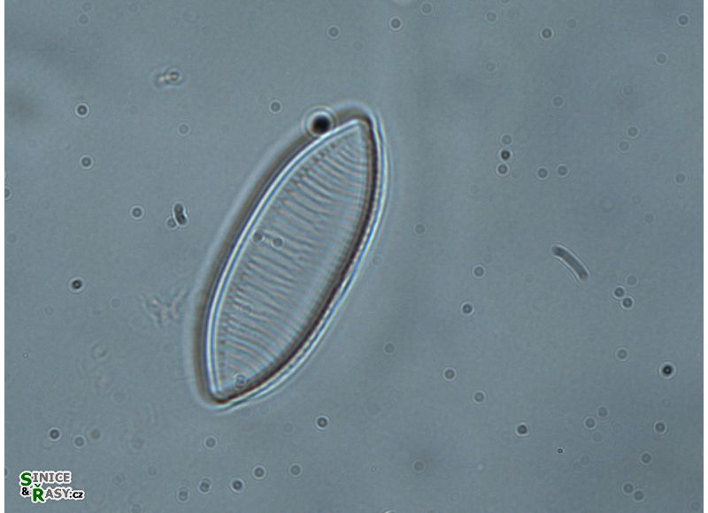 Nitzschia tryblionella