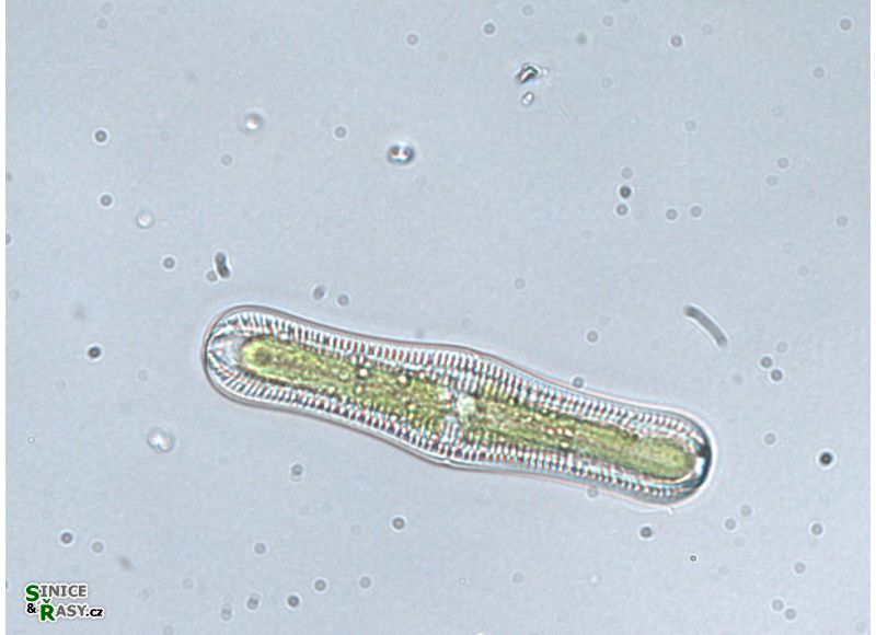 Rhopalodia gibba