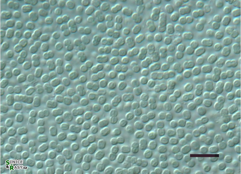 Cyanobacterium