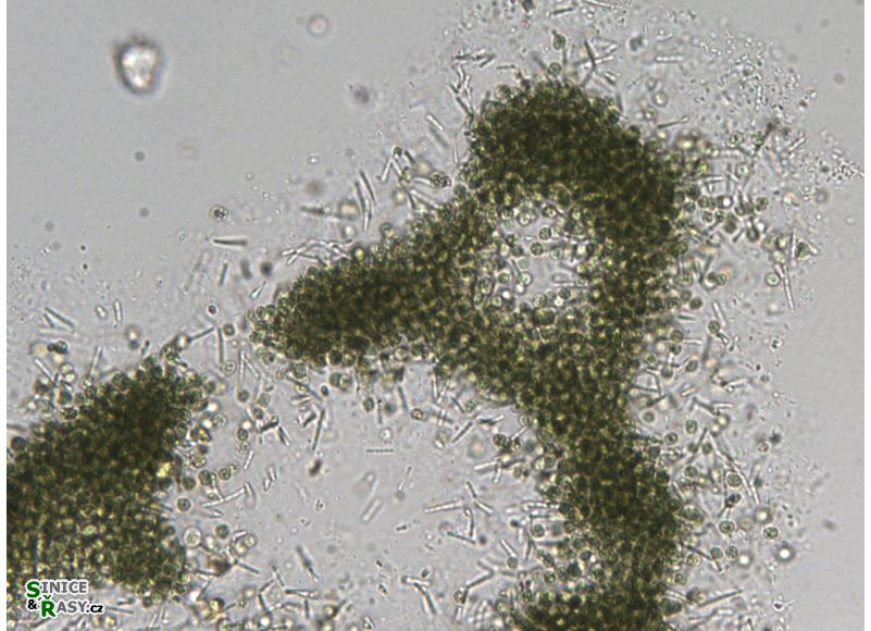 Microcystis aeruginosa