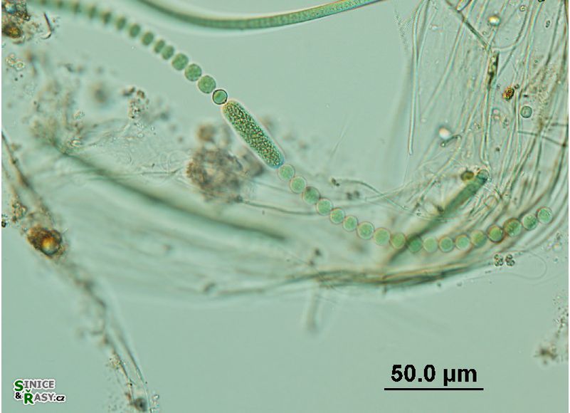 Anabaena