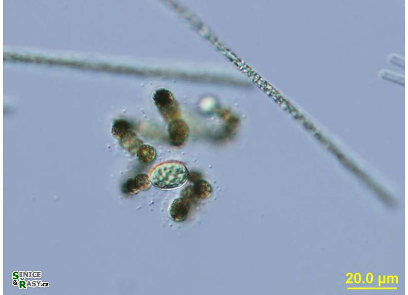Dolichospermum spiroides