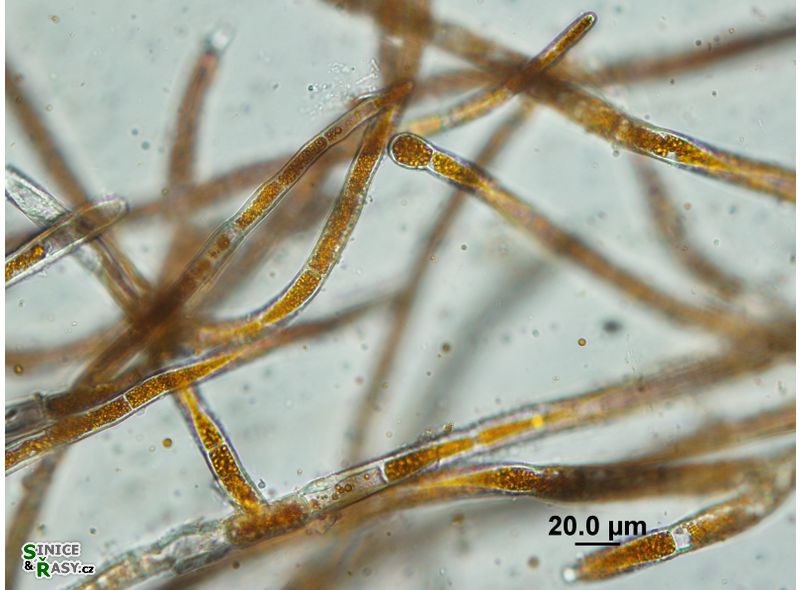 Trentepohlia aurea