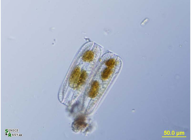 Surirella