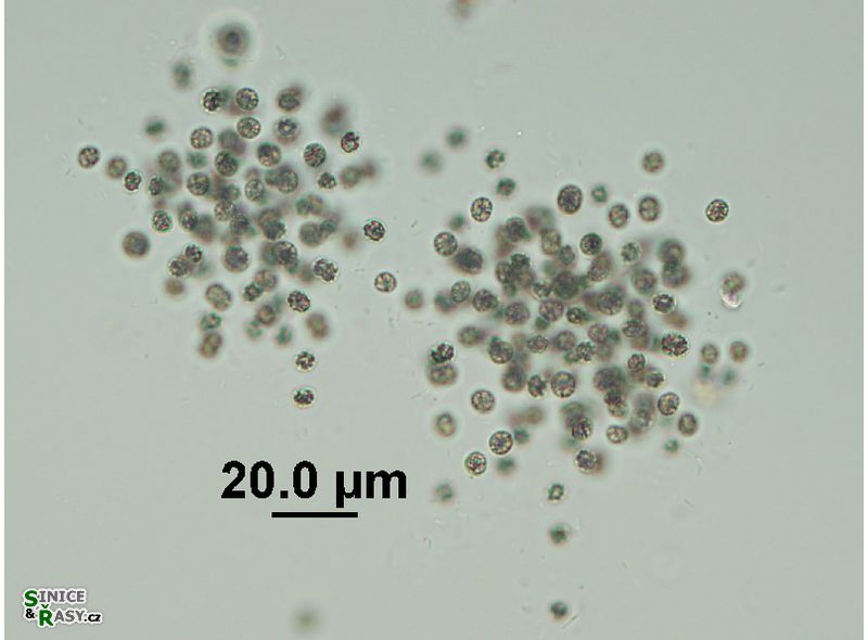 Rradiocystis geminata