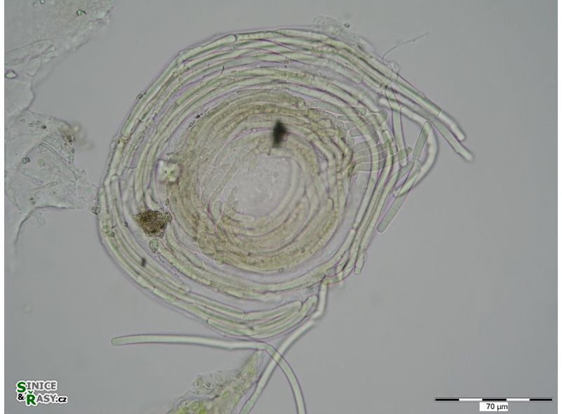 Phormidium vulgare