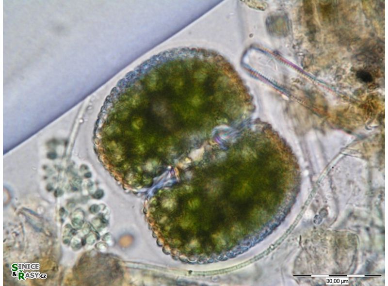 Cosmarium conspersum