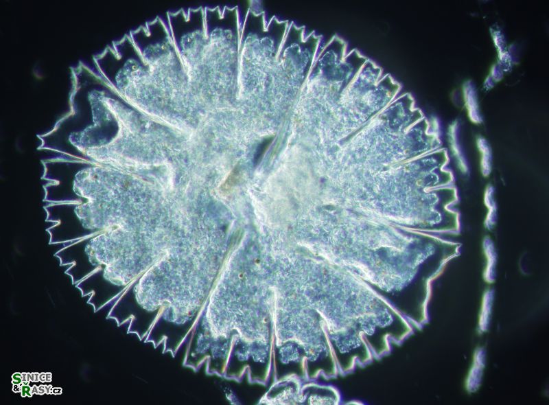 Micrasterias rotata