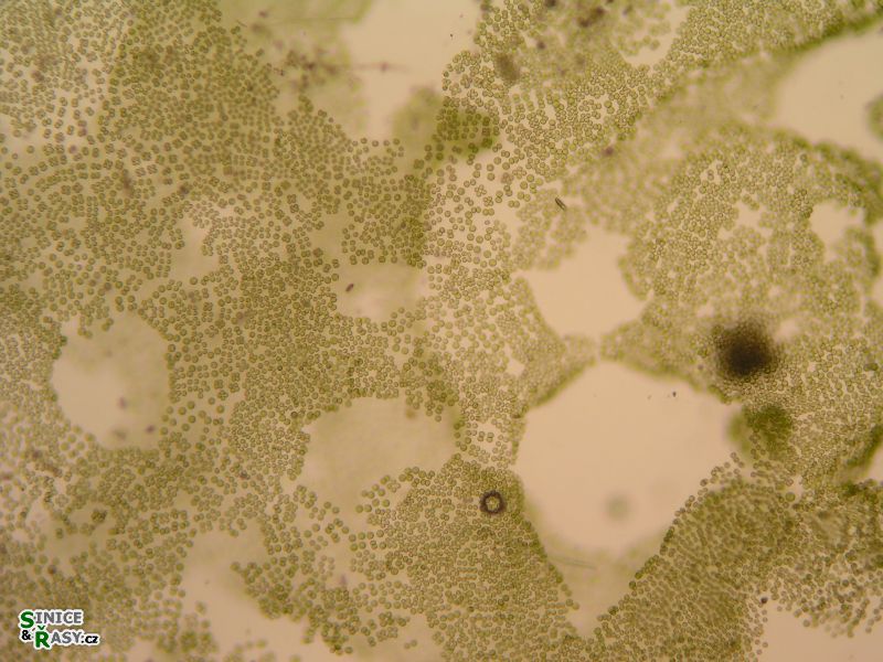 Tetraspora cylindrica