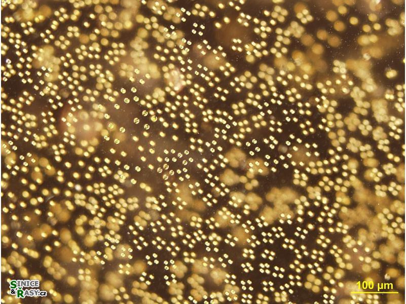 Tetraspora gelatinosa