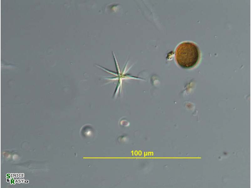 Ankistrodesmus fusiformis