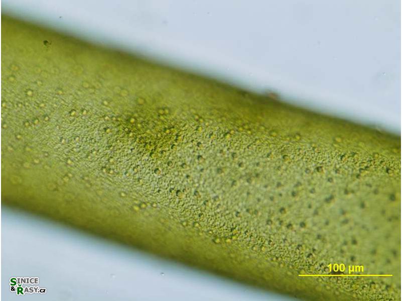 Hydrodictyon reticulatum