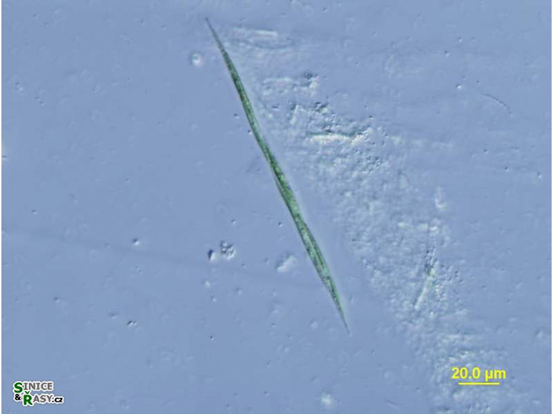 Monoraphidium griffithii