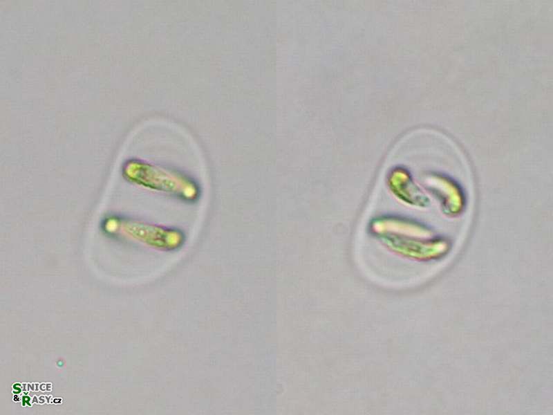 Nephrocytium