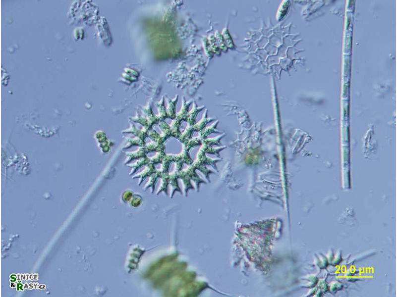 Parapediastrum biradiatum