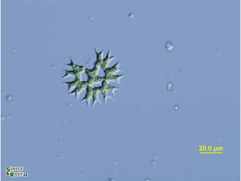 Parapediastrum biradiatum