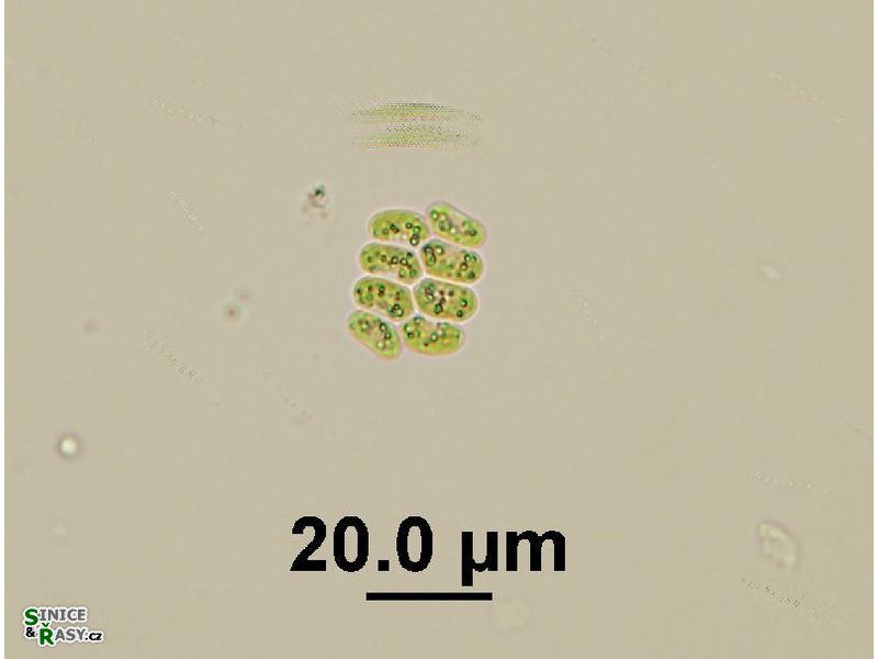 Scenedesmus obtusus var. disciformis