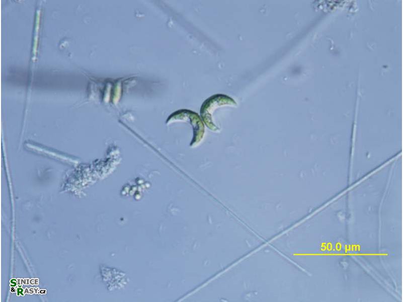 Selenastrum bibrainum