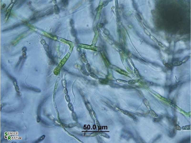 Aphanochaete sp.
