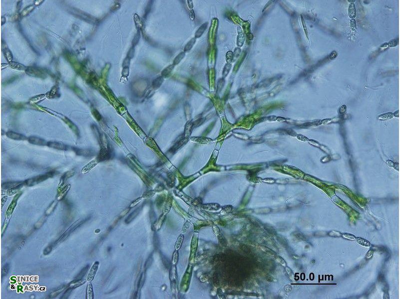 Aphanochaete sp.