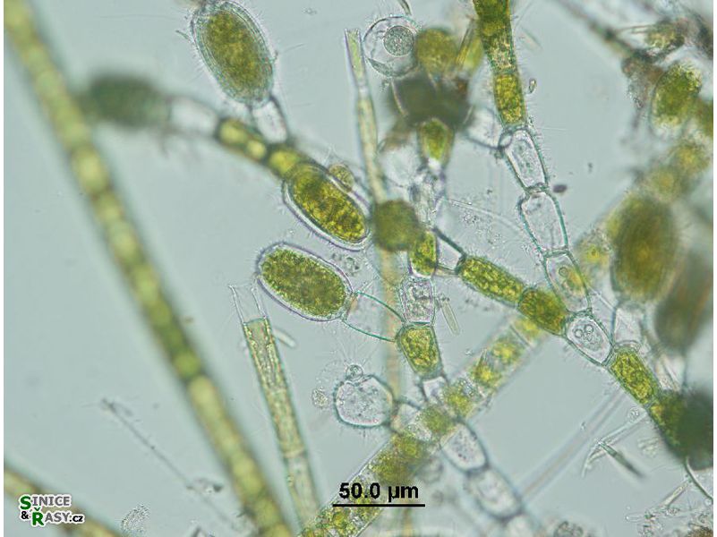 Bulbochaete sp.