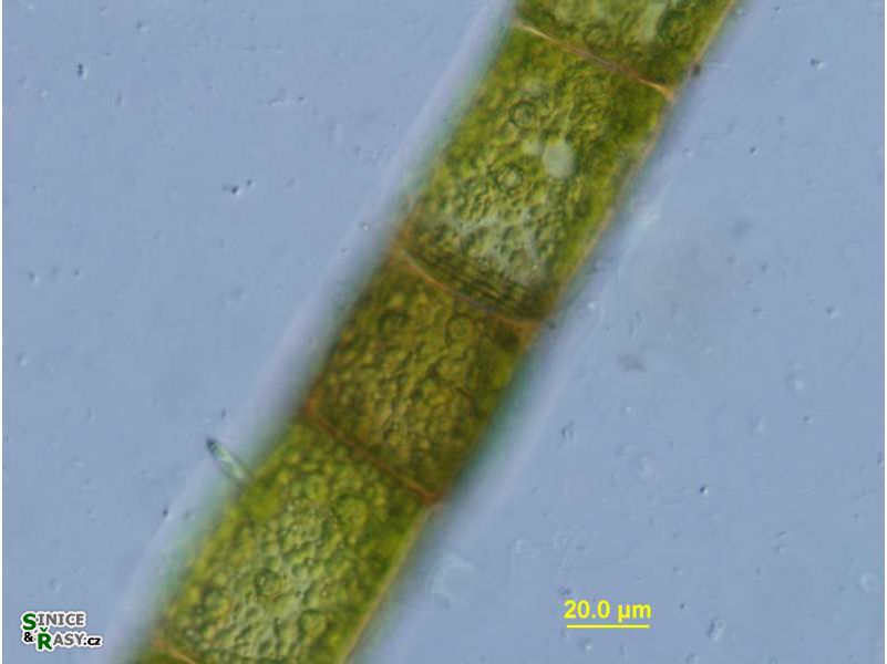 Oedogonium