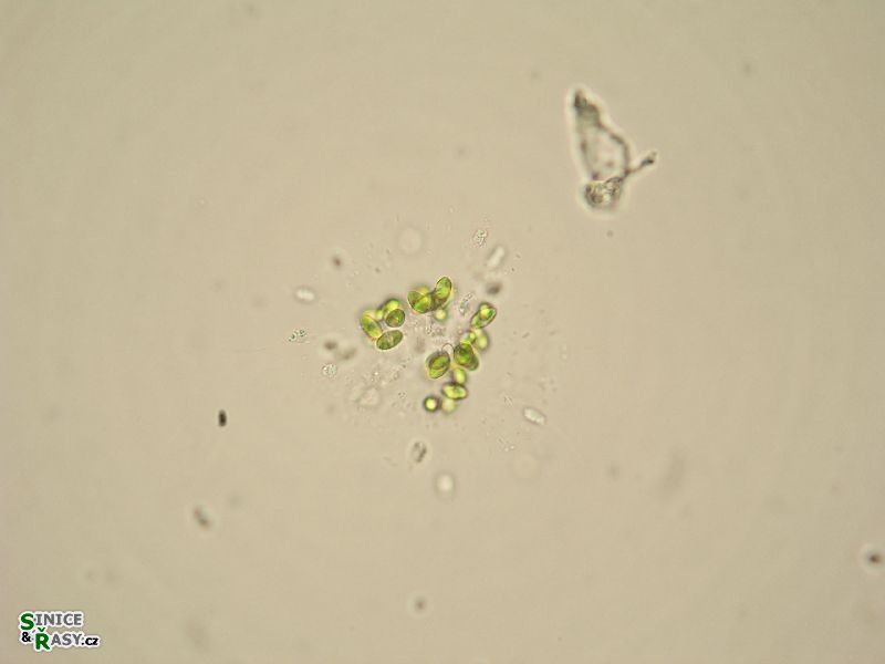 Dictyosphaerium ehrenbergianum